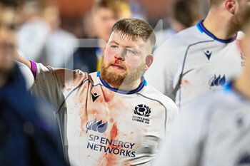 2022-02-25 - Scotland's Ali Rogers is bloodied after the final whistle during the Under - 20 Six Nations 2022, rugby union match between Scotland and France on February 25, 2022 at the DAM Healthcare Stadium in Edinburgh, Scotland - UNDER - 20 SIX NATIONS 2022 - SCOTLAND VS FRANCE - WORLD CUP - RUGBY